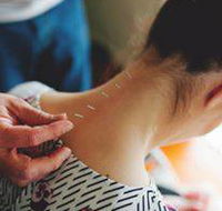 Scott Martin Acupuncture