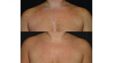 Skinworx Skin Cosmetic & Wellness Centre - LBG 2