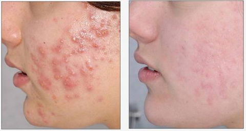 Skinworx Skin Cosmetic & Wellness Centre - LBG 4