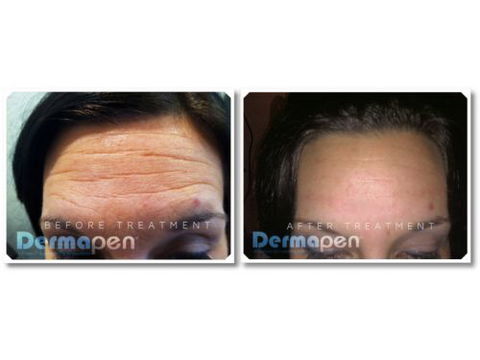 Skinworx Skin Cosmetic & Wellness Centre - LBG 5