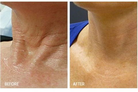 Skinworx Skin Cosmetic & Wellness Centre - LBG 11