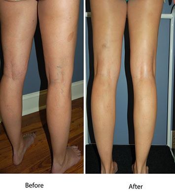 Skinworx Skin Cosmetic & Wellness Centre - LBG 14