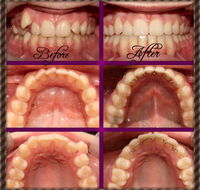 Coral Coast Dental - LBG