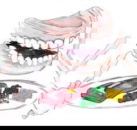 Dannalees Mobile Denture Service - LBG