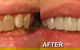 Ooralea Dental Care - thumb 1