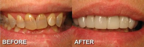 Ooralea Dental Care - LBG 1