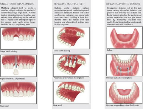 Ooralea Dental Care - LBG 2