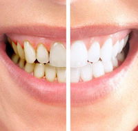 Graham Johnson Dental Surgeon - LBG