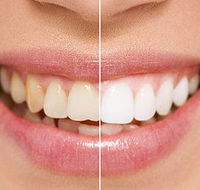 Newcastle Dental Care - LBG