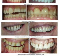 Smile Craft Dental - LBG