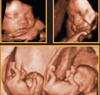 Sarina Medical Imaging - LBG