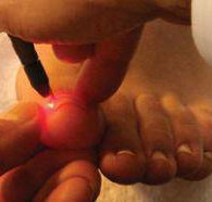 Mullumbimby Podiatry Laser Clinic - LBG